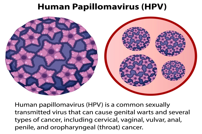 HPV Enfeksiyonu Nedir